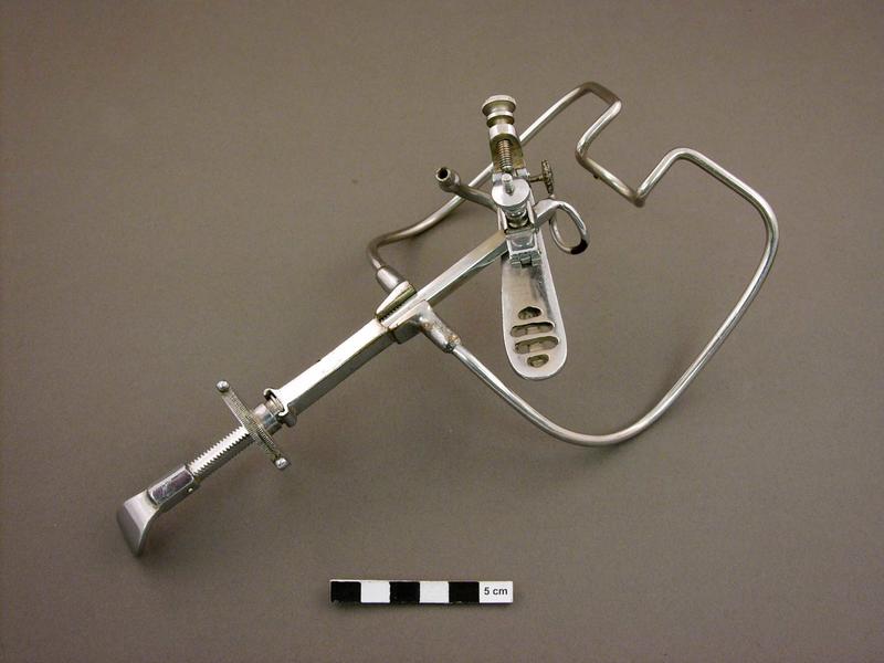 Tonsillectomy mouth gag with tongue blade Faculty of Medicine