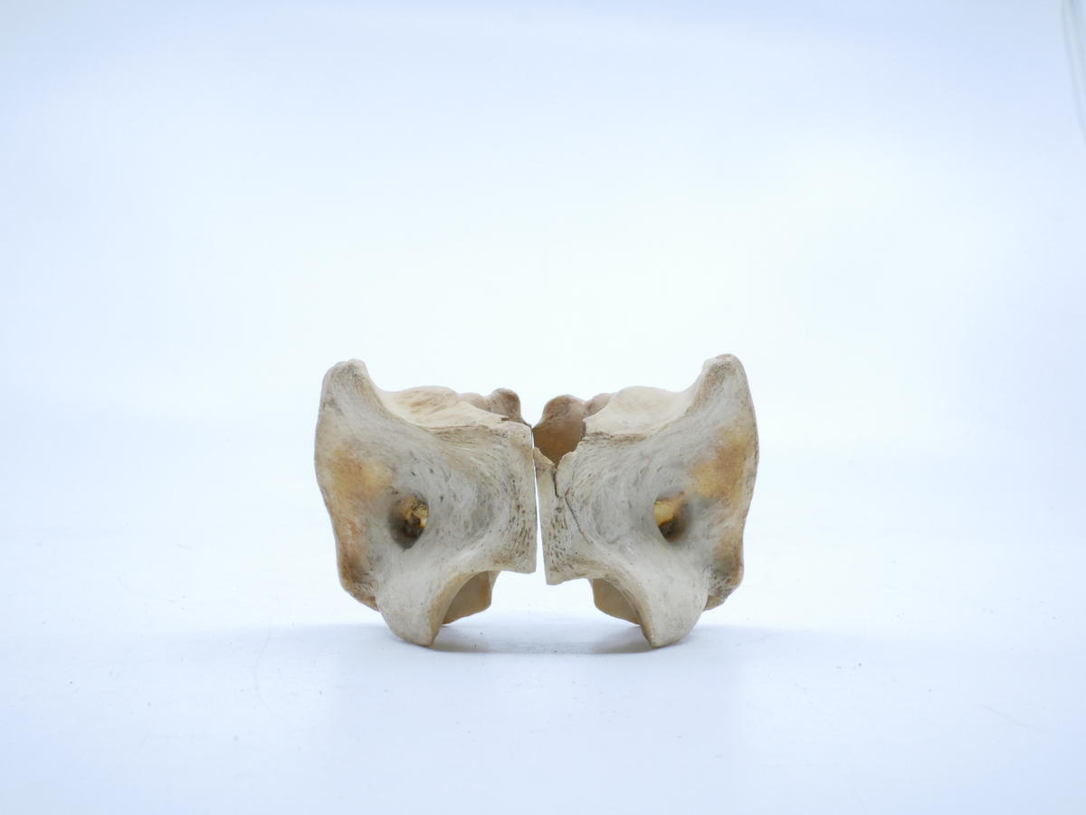 Sheep or goat, bisected atlas vertebra - Faculty of Medicine, Dentistry