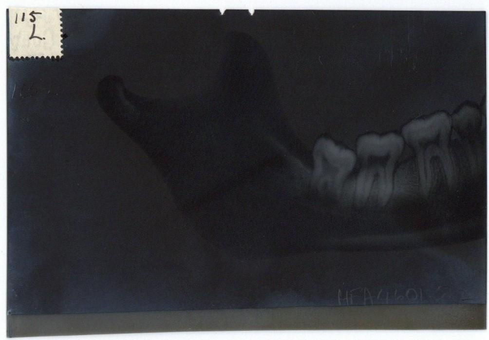 Set of two extra oral radiographs with brown folders Tasmanian Thesis