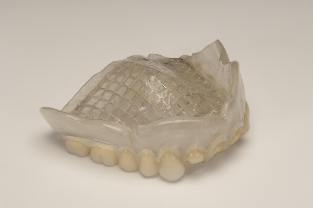 Full upper denture Faculty of Medicine, Dentistry and Health Sciences