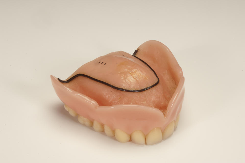 Full upper acrylic denture Faculty of Medicine, Dentistry and Health Sciences Museums at The